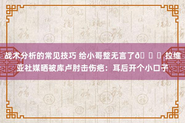 战术分析的常见技巧 给小哥整无言了😅拉维亚社媒晒被库卢肘击伤疤：耳后开个小口子